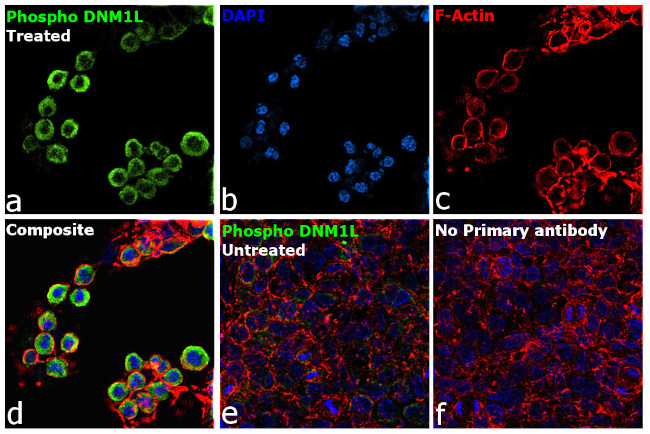 Phospho-DNM1L (Ser616) Antibody in Immunocytochemistry (ICC/IF)