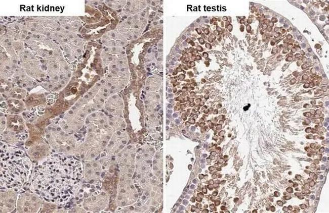 ADAMTSL2 Antibody in Immunohistochemistry (Paraffin) (IHC (P))