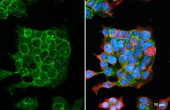 AGTR1 Antibody in Immunocytochemistry (ICC/IF)