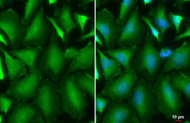AKT1 Antibody in Immunocytochemistry (ICC/IF)
