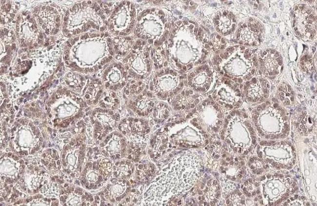 AKT1 Antibody in Immunohistochemistry (Paraffin) (IHC (P))