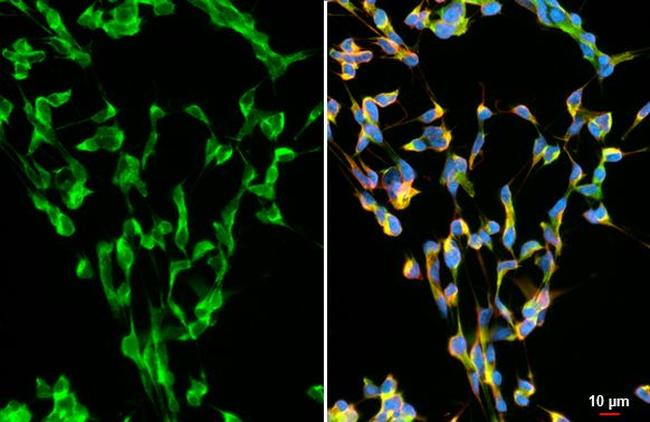 alpha Synuclein Antibody in Immunocytochemistry (ICC/IF)