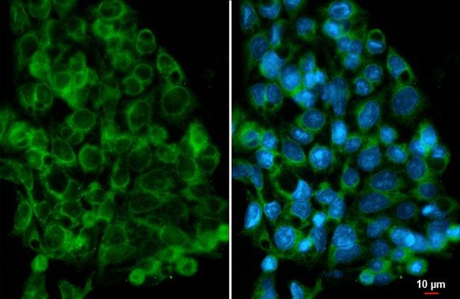 AMFR Antibody in Immunocytochemistry (ICC/IF)