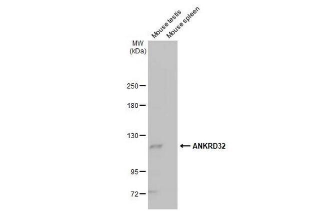 ANKRD32 Antibody in Western Blot (WB)