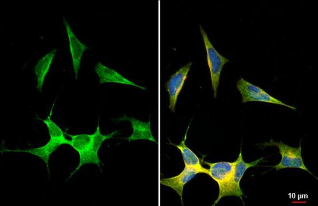 ANP Antibody in Immunocytochemistry (ICC/IF)