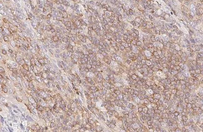ARL13B Antibody in Immunohistochemistry (Paraffin) (IHC (P))