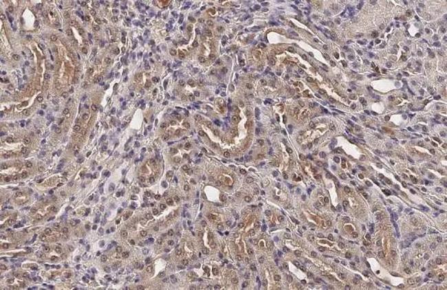 BCKDK Antibody in Immunohistochemistry (Paraffin) (IHC (P))
