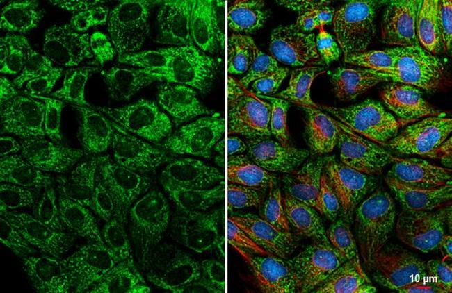 BCL-XL Antibody in Immunocytochemistry (ICC/IF)
