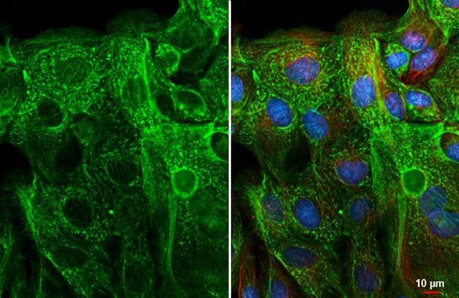 BCL-XL Antibody in Immunocytochemistry (ICC/IF)
