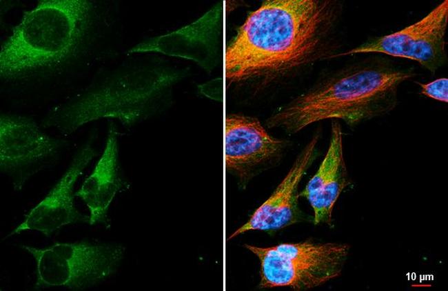 Beclin 1 Antibody in Immunocytochemistry (ICC/IF)