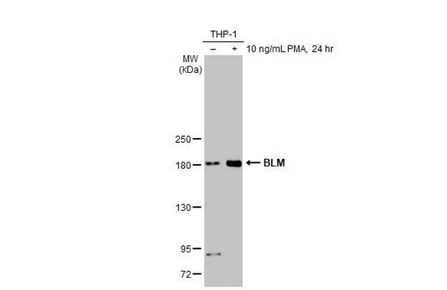 Blooms Syndrome Antibody in Western Blot (WB)