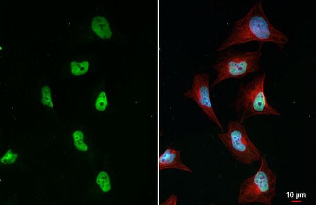 BRD4 Antibody in Immunocytochemistry (ICC/IF)