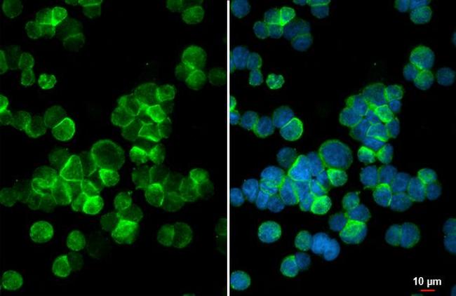 C3a Receptor Antibody in Immunocytochemistry (ICC/IF)