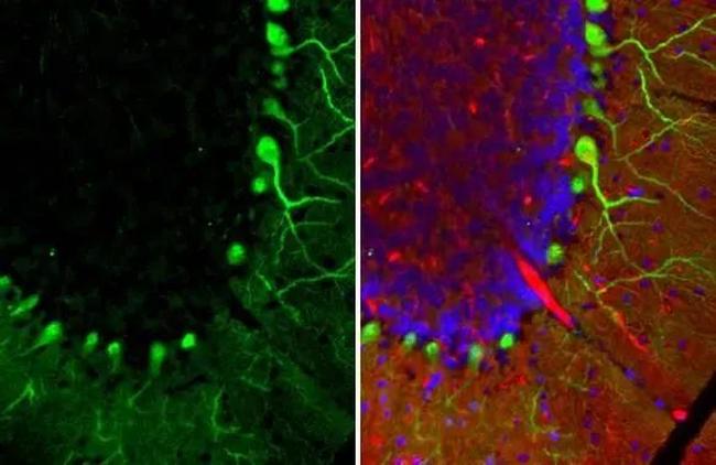 Calbindin D28K Antibody in Immunohistochemistry (Paraffin) (IHC (P))