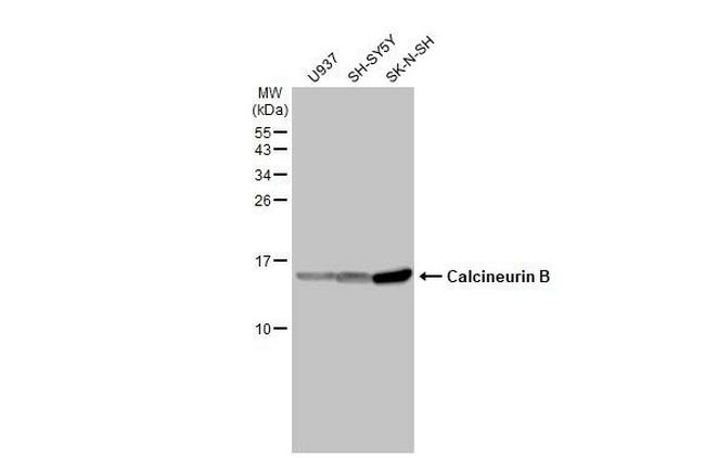 Calcineurin B Antibody in Western Blot (WB)