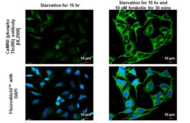 Phospho-CaMKII alpha (Thr286) Antibody in Immunocytochemistry (ICC/IF)