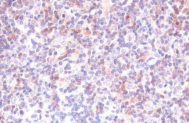 Caspase 3 Antibody in Immunohistochemistry (Paraffin) (IHC (P))