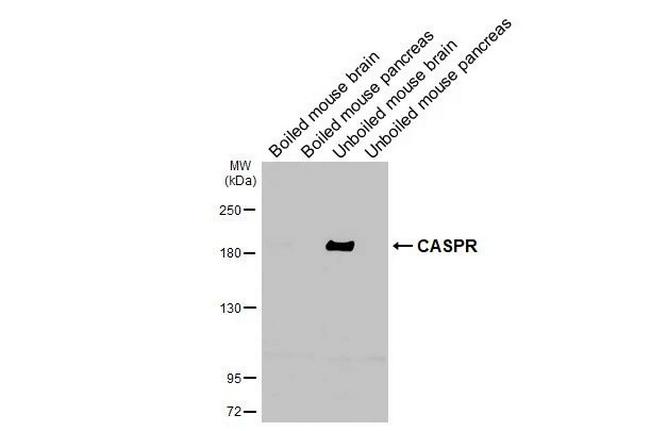 CNTNAP1 Antibody in Western Blot (WB)