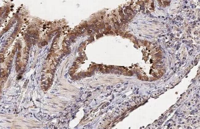 NOV Antibody in Immunohistochemistry (Paraffin) (IHC (P))