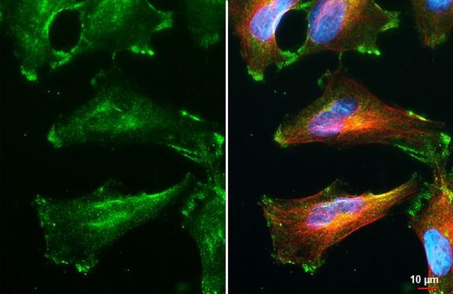 NOV Antibody in Immunocytochemistry (ICC/IF)