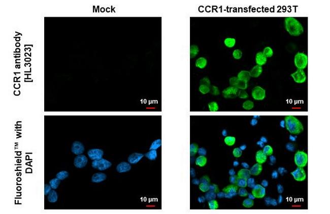 CCR1 Antibody in Immunocytochemistry (ICC/IF)