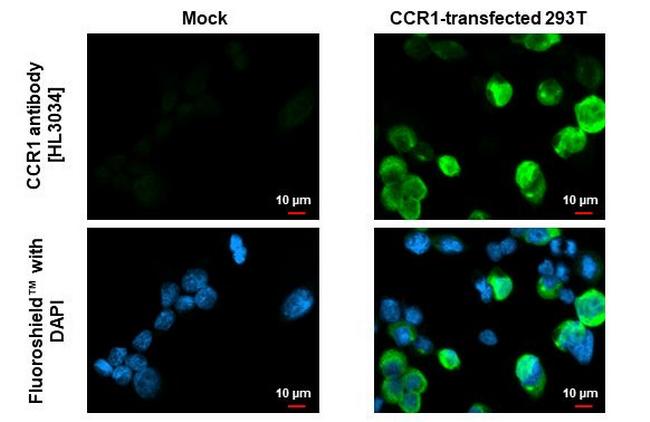 CCR1 Antibody in Immunocytochemistry (ICC/IF)