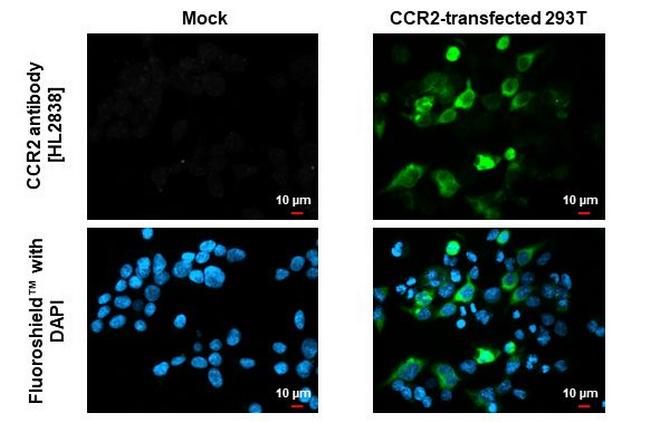 CCR2 Antibody in Immunocytochemistry (ICC/IF)
