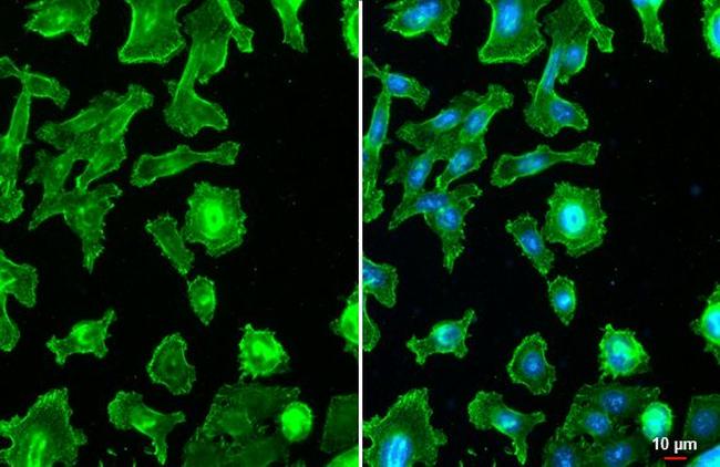 CCR4 Antibody in Immunocytochemistry (ICC/IF)