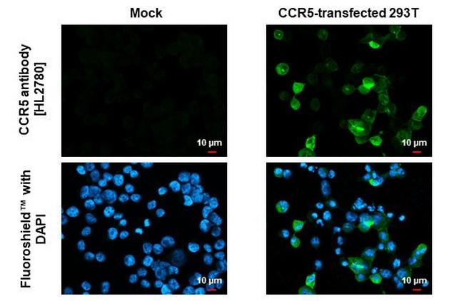 CCR5 Antibody in Immunocytochemistry (ICC/IF)