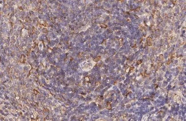 CCR7 Antibody in Immunohistochemistry (Paraffin) (IHC (P))