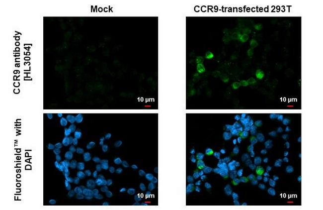 CCR9 Antibody in Immunocytochemistry (ICC/IF)