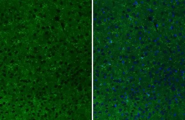 CD11b Antibody in Immunohistochemistry (Paraffin) (IHC (P))