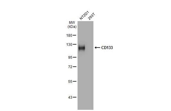 CD133 Antibody in Western Blot (WB)