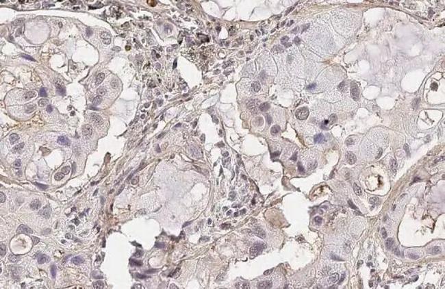 CD73 Antibody in Immunohistochemistry (Paraffin) (IHC (P))