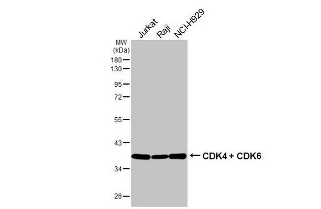 CDK4/CDK6 Antibody in Western Blot (WB)