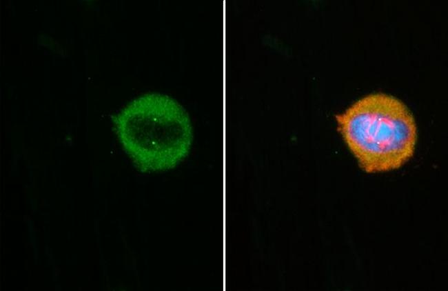 CEP152 Antibody in Immunocytochemistry (ICC/IF)