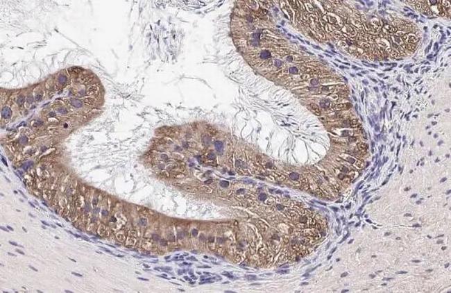 CHD4 Antibody in Immunohistochemistry (Paraffin) (IHC (P))