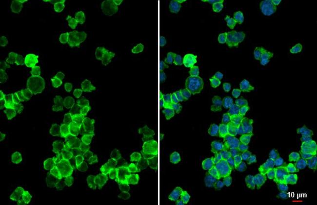 CHI3L1 Antibody in Immunocytochemistry (ICC/IF)