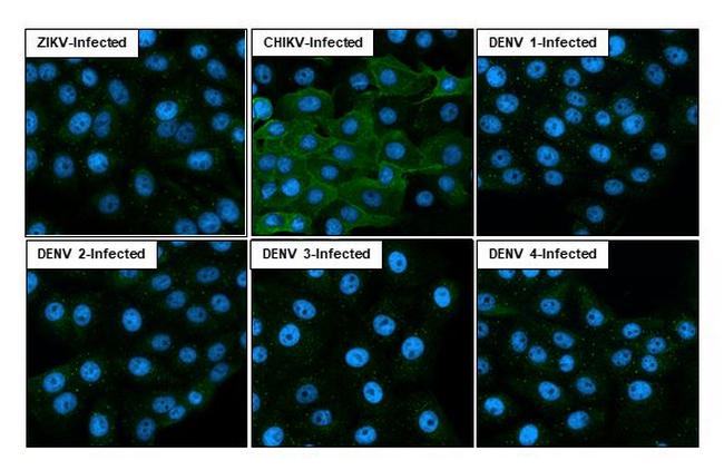 Chikungunya Virus NSP1 (S27-African prototype) Antibody in Immunocytochemistry (ICC/IF)