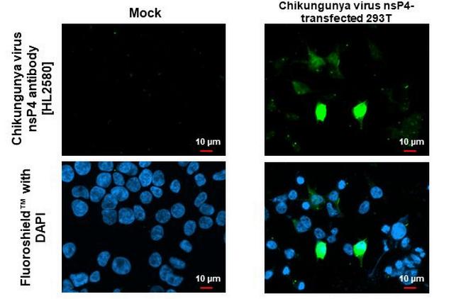 Chikungunya Virus NSP4 (S27-African prototype) Antibody in Immunocytochemistry (ICC/IF)