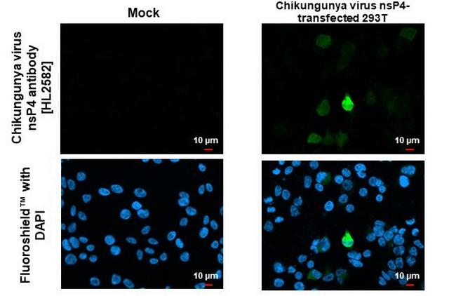 Chikungunya Virus NSP4 (S27-African prototype) Antibody in Immunocytochemistry (ICC/IF)