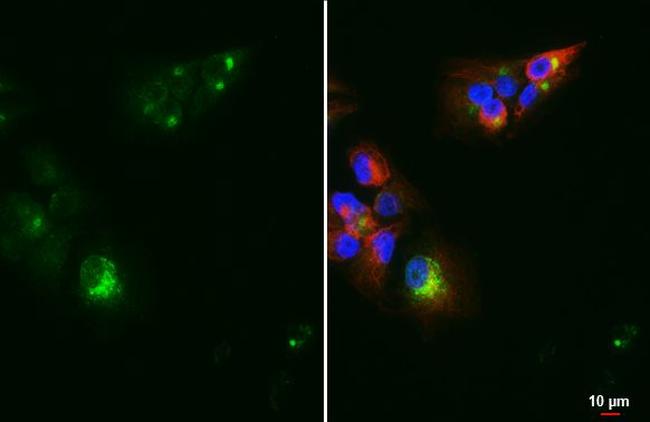 Chromogranin C Antibody in Immunocytochemistry (ICC/IF)