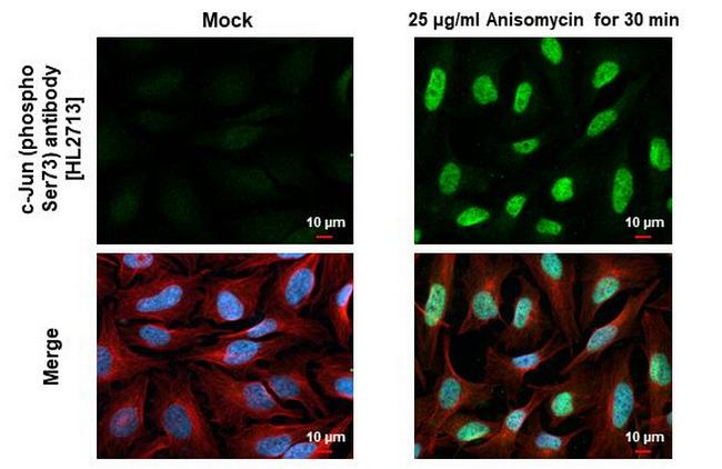 Phospho-c-Jun (Ser73) Antibody in Immunocytochemistry (ICC/IF)