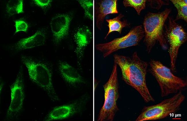 CKAP4 Antibody in Immunocytochemistry (ICC/IF)