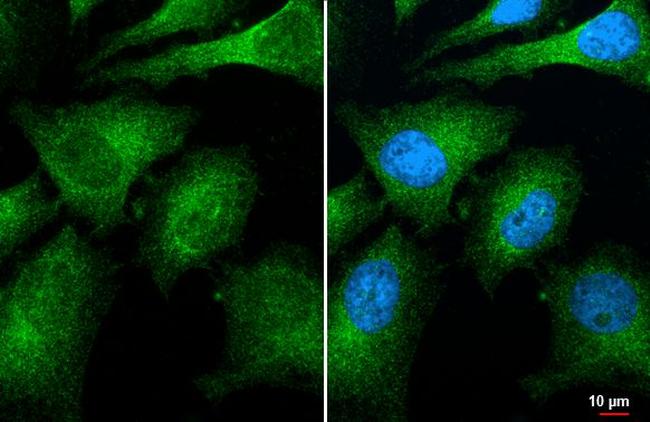 CNOT8 Antibody in Immunocytochemistry (ICC/IF)