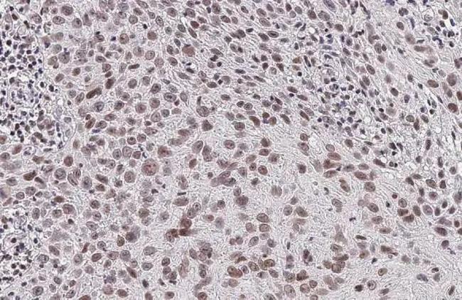 Phospho-CREB (Ser133) Antibody in Immunohistochemistry (Paraffin) (IHC (P))