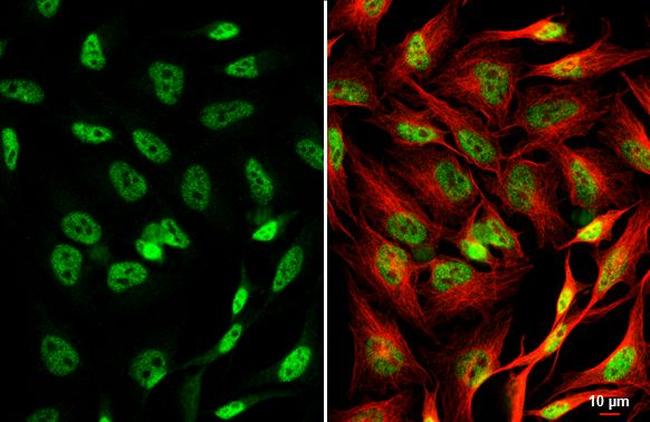 CREB Antibody in Immunocytochemistry (ICC/IF)
