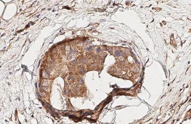 CXCR3 Antibody in Immunohistochemistry (Paraffin) (IHC (P))