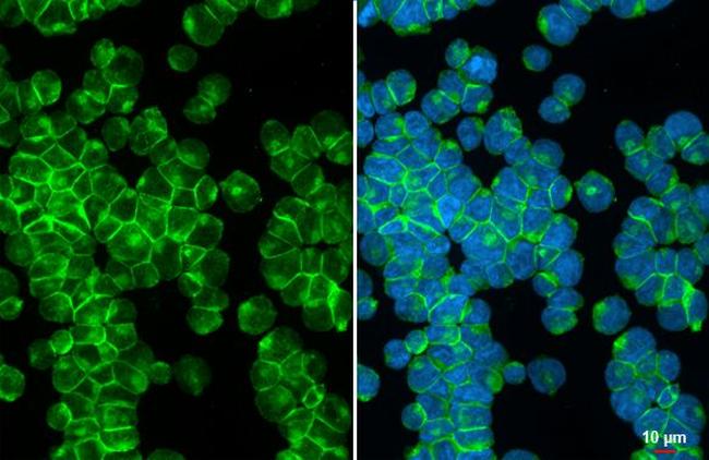 CXCR4 Antibody in Immunocytochemistry (ICC/IF)