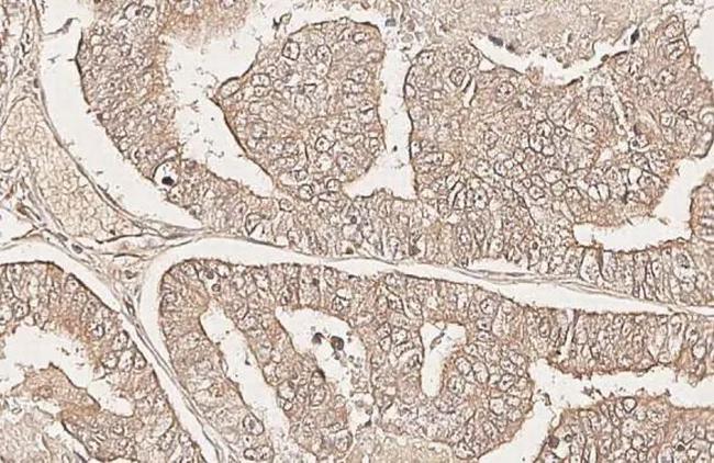 CXCR6 Antibody in Immunohistochemistry (Paraffin) (IHC (P))